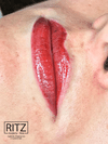 Curso Micropigmentação Labial