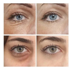 Parches para ojos antiedad ojeras mascarillas - tienda online