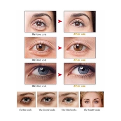 Masajeador antiarrugas facial ojos y labios - tienda online