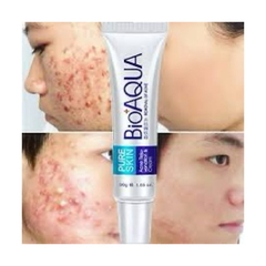 Bioaqua crema para acne - tienda online