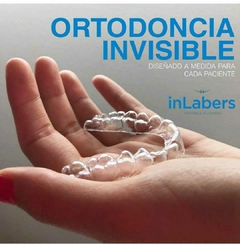 Ortodoncia Invisible: Luce una sonrisa perfecta sin sacrificar tu estética