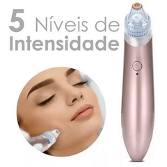 Extrator Cravos Facial A Vácuo / Xn-8030 - Elétrico - Esfoliante Limpeza Facial