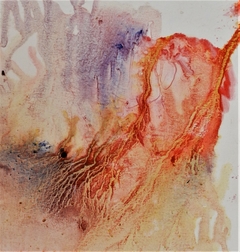 Pleura 1 - arte La Lucila