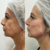 Harmonização Facial | Meviza na internet