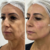 Harmonização Facial | Meviza - comprar online