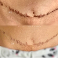 CURSO TATUAGEM PARAMÉDICA “MÉTODO PERFECT SKIN"