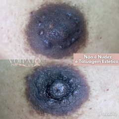 CURSO TATUAGEM PARAMÉDICA “MÉTODO PERFECT SKIN" - loja online