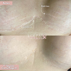 CURSO TATUAGEM PARAMÉDICA “MÉTODO PERFECT SKIN"