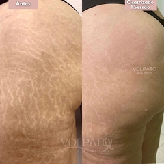 CURSO TATUAGEM PARAMÉDICA “MÉTODO PERFECT SKIN" - Volpato pmu & Academy