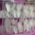 Imagen de Caja x420 tips prelimados