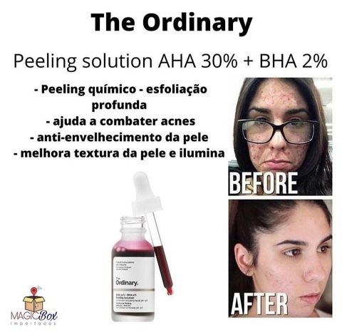 Peeling AHA 30% + BHA 2%