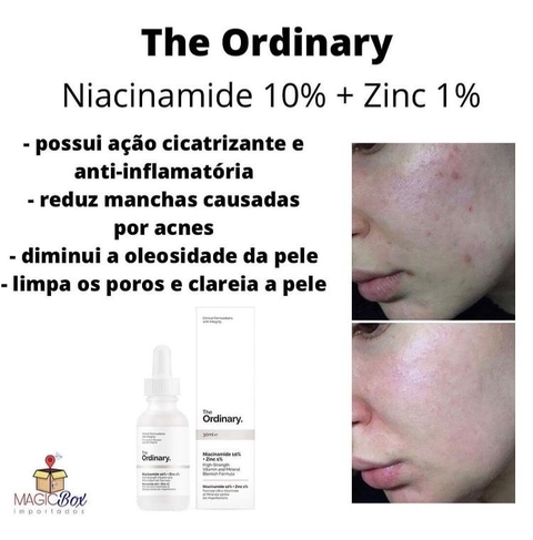 Niacinamide 10% + Zinc 1%