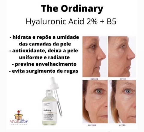 The Ordinary Hyaluronic Acid 2% + B5