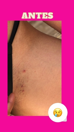 Imagem do POMADA CLAREADORA, CICATRIZANTE E MULTIFUNCIONAL 40g