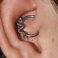 Perfuração de Daith