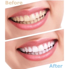 Blanqueador Dental Whitening Oral Gel 44% Peroxido Premium - UNISHOPS