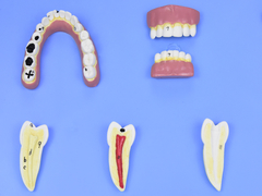 SD-5059/L - MODELO DE PATOLOGIAS DENTÁRIAS C/ 12 PARTES EM PLACA - comprar online