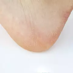 COONY FOOT PEELING MASK ¡Pies totalmente renovados! - tienda online
