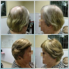 Próteses de Cabelo Natural Real ( Feita sob Medidas) com orçamento somente na loja