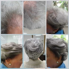 Próteses de Cabelo Natural Real ( Feita sob Medidas) com orçamento somente na loja