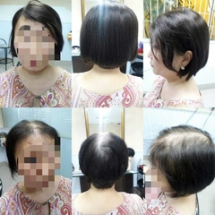 Próteses de Cabelo Natural Real ( Feita sob Medidas) com orçamento somente na loja