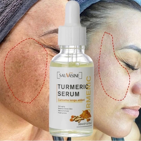 Sérum Turmeric Iluminador + Frete Grátis