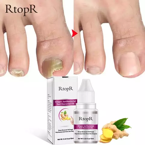 FungiPró RtopR® 3 em 1 (Reparador, Restaurador e Fortalecedor de Unhas)