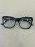 OCULOS DE GRAU