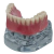 Macro Modelo Anatômico Odontológico Mandíbula Overdenture Acrílica com 2 Barra Clip e Prótese Inferior