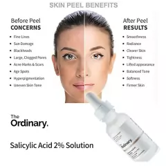 Salicylic Acid 2% Solution en internet