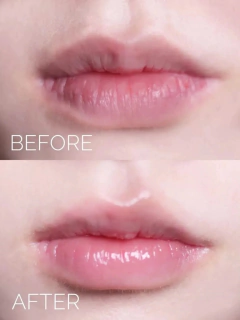 Mascarilla de labios - Laneige - Glow Up