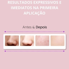 APARELHO REMOVEDOR DE CRAVOS VIA SUCÇÃO na internet