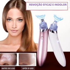 APARELHO REMOVEDOR DE CRAVOS VIA SUCÇÃO - comprar online