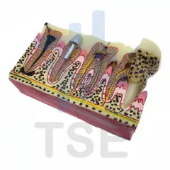 tipodonto dental patologías