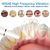 Desincrustador dental ultrassônico para remoção de cálculos dentários de manchas de tártaro elétrico limpador de placa de dentes sônicos remoção de pedras dentárias - comprar online