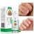 SUAI Tratamento de fungos nas unhas Cuidados com os pés Essência reparo nos pés Remoção de fungos nas unhas Sérum gel anti-infecção Paroníquia Onicomicose - Revolução Z