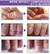 SUAI Tratamento de fungos nas unhas Cuidados com os pés Essência reparo nos pés Remoção de fungos nas unhas Sérum gel anti-infecção Paroníquia Onicomicose - loja online