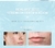 AUQUEST Acne Tratamento Creme Facial Ácido Salicílico Óleo Contro Clareamento Encolher Poros Beleza Saúde Coreano Cosméticos Cuidados com a Pele - loja online