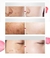 Creme Clareador Eficaz Para Sardas Remover Manchas Escuras Melanina Melasma Beleza Cuidados com a Pele Clarear Antienvelhecimento Firme Cosméticos Coreanos - lllll