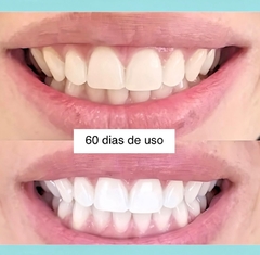 COMBO 3UN GEL DENTAL COM NANOEMULSÃO DE ÓLEO ESSENCIAL DE ALECRIM, EXTRATOS DE ALOE VERA, MELALEUCA, ÓLEOS DE TORANJA E LIMÃO TAHITI - SEM FLÚOR - 90g - Akmos Curitiba