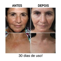 RENOVE GOMAGE ESFOLIANTE COM NANOTECNOLOGIA - 150g - loja online