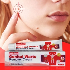 Creme para Verrugas - 20g, Mãos, Pés, Rosto e para as partes genitais - comprar online
