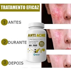 Suplemento Anti Acne - 60 capsulas 500mg - comprar online