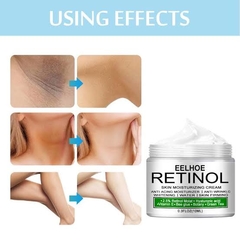 Retinol - Creme branqueador corporal (Axilas, virilha, cotovelo, pescoço..) - comprar online