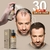 Purc Hair Growth Spray Natural Ginger Essence Spray Extrato Eficaz Anti Queda de na internet