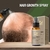 Purc Hair Growth Spray Natural Ginger Essence Spray Extrato Eficaz Anti Queda de - loja online