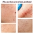 Dispositivos de lifting facial 7 em 1 EMS RF Microcorrente Rejuvenescimento da p