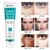 Imagem do Clareamento Sardas Creme Hidratante Facial Remover Manchas Escuras Melanina Removedor de Melasma Iluminando a Pele Reparo Eficaz Antienvelhecimento