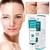 Clareamento Sardas Creme Hidratante Facial Remover Manchas Escuras Melanina Removedor de Melasma Iluminando a Pele Reparo Eficaz Antienvelhecimento na internet