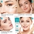 Clareamento Sardas Creme Hidratante Facial Remover Manchas Escuras Melanina Removedor de Melasma Iluminando a Pele Reparo Eficaz Antienvelhecimento